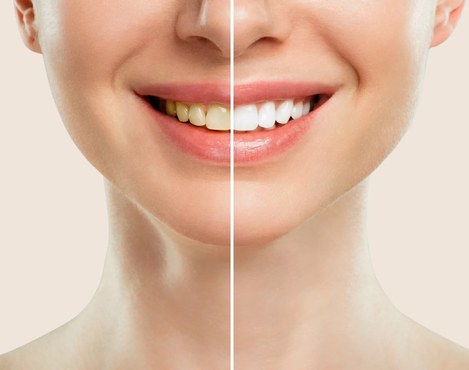 Cosmetic Dentist in the Upper East Side, New York – Uptown Dentistry