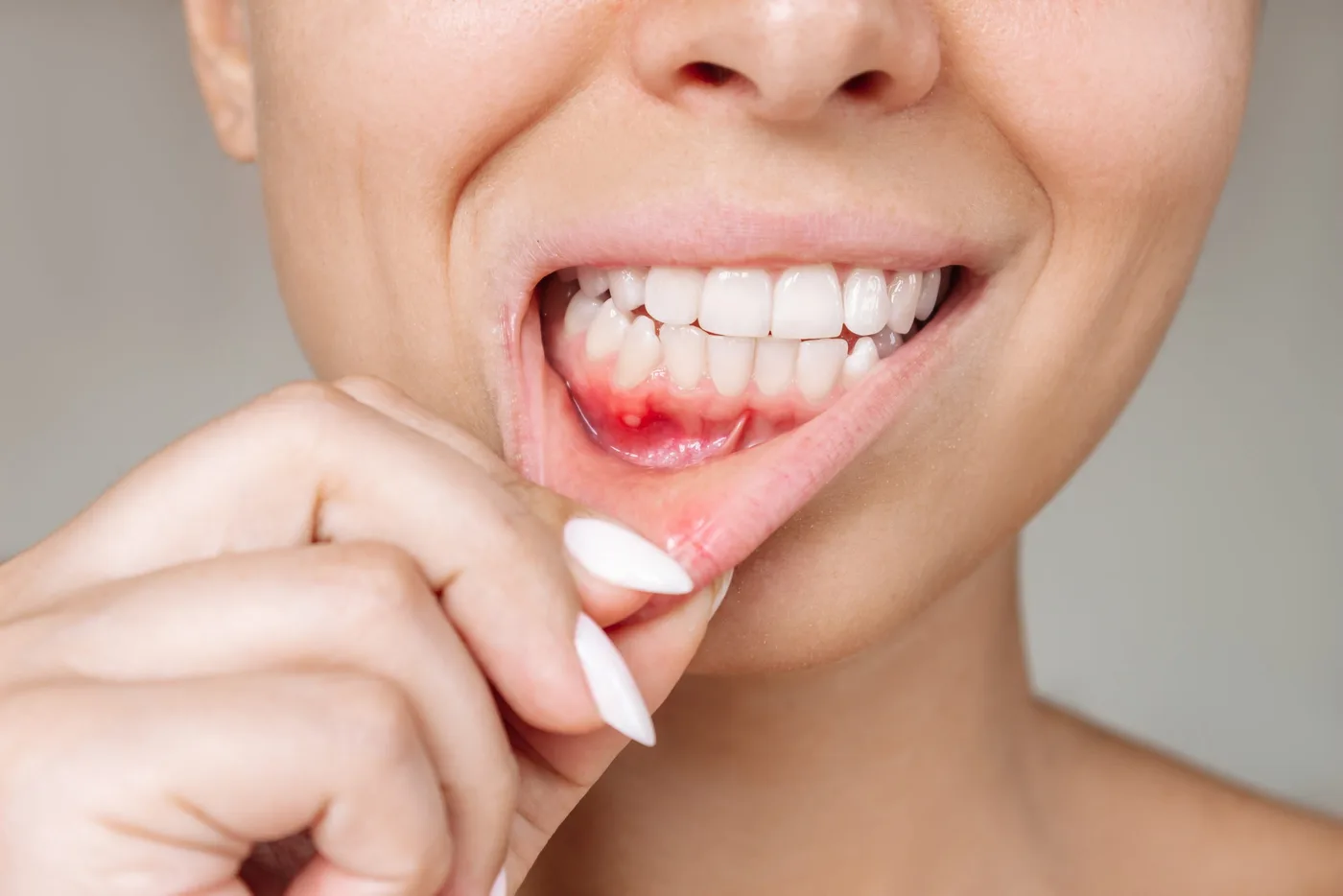 Gum Disease Treatment in the Upper East Side, New York – Uptown Dentistry